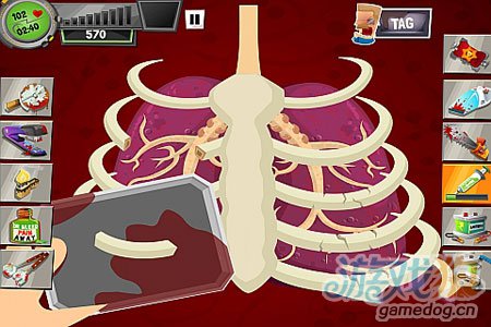 疯狂外科医生3iPhone评测：要命的外科手术7